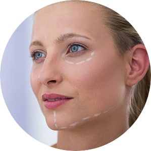 Face & Neck Lift