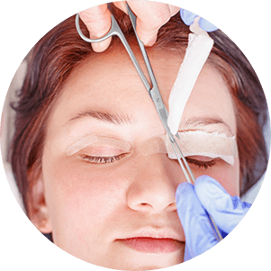 Blepharoplasty